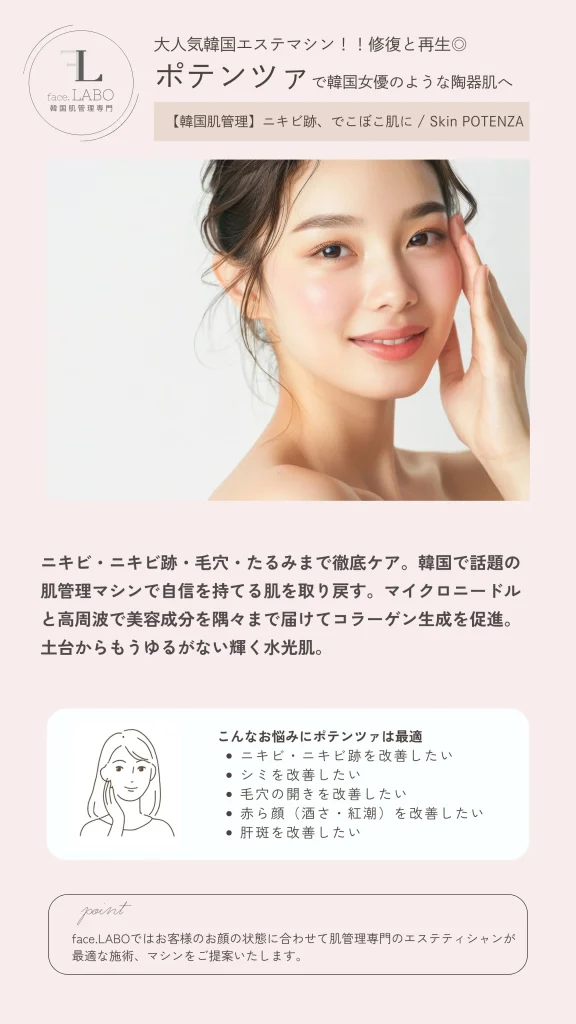 つくば市-ポテンツァ-ニキビや肝斑に