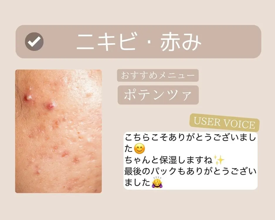 つくば-ポテンツァ-お客様の声