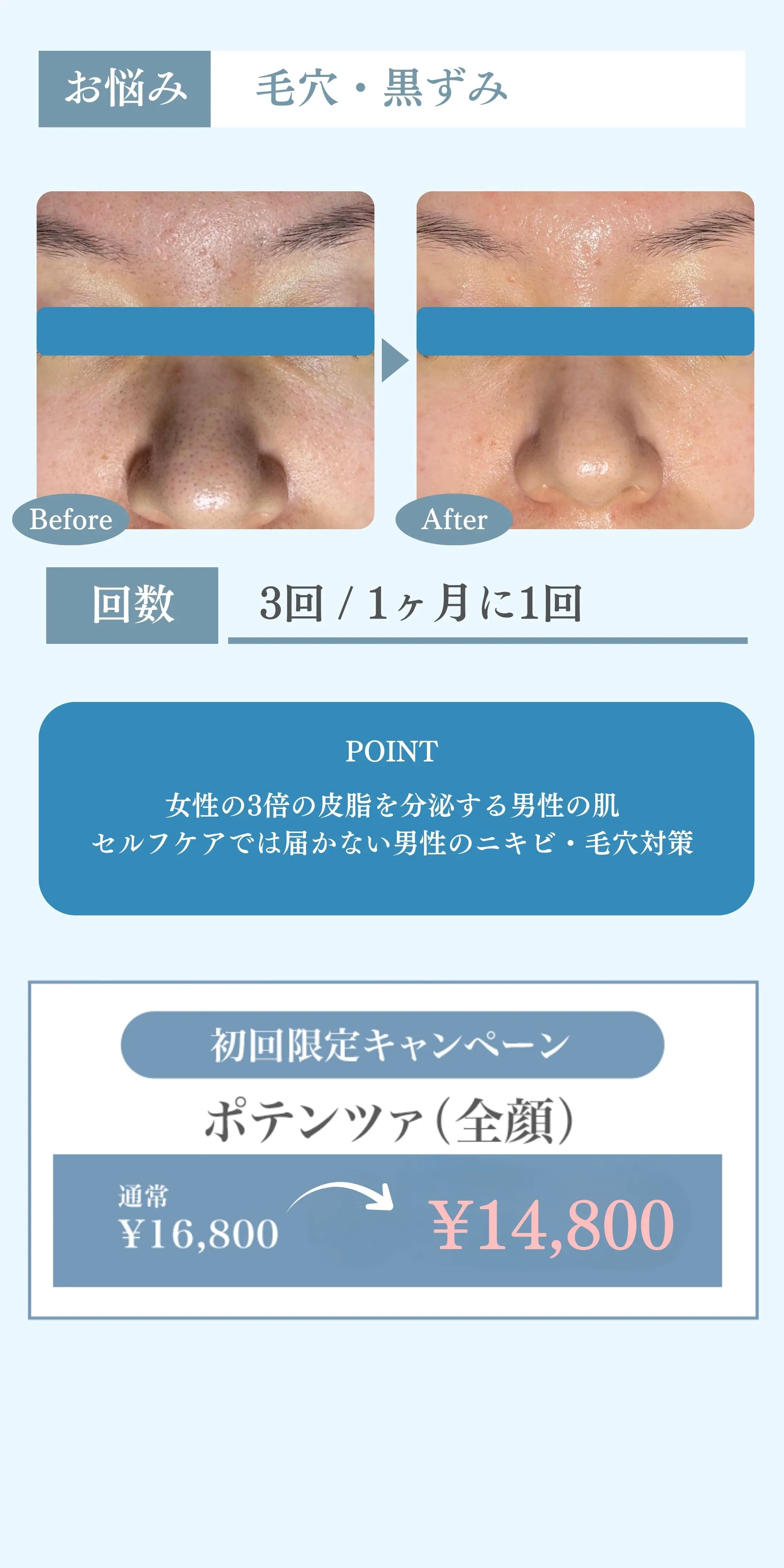 毛穴-つくば市-face.LABO