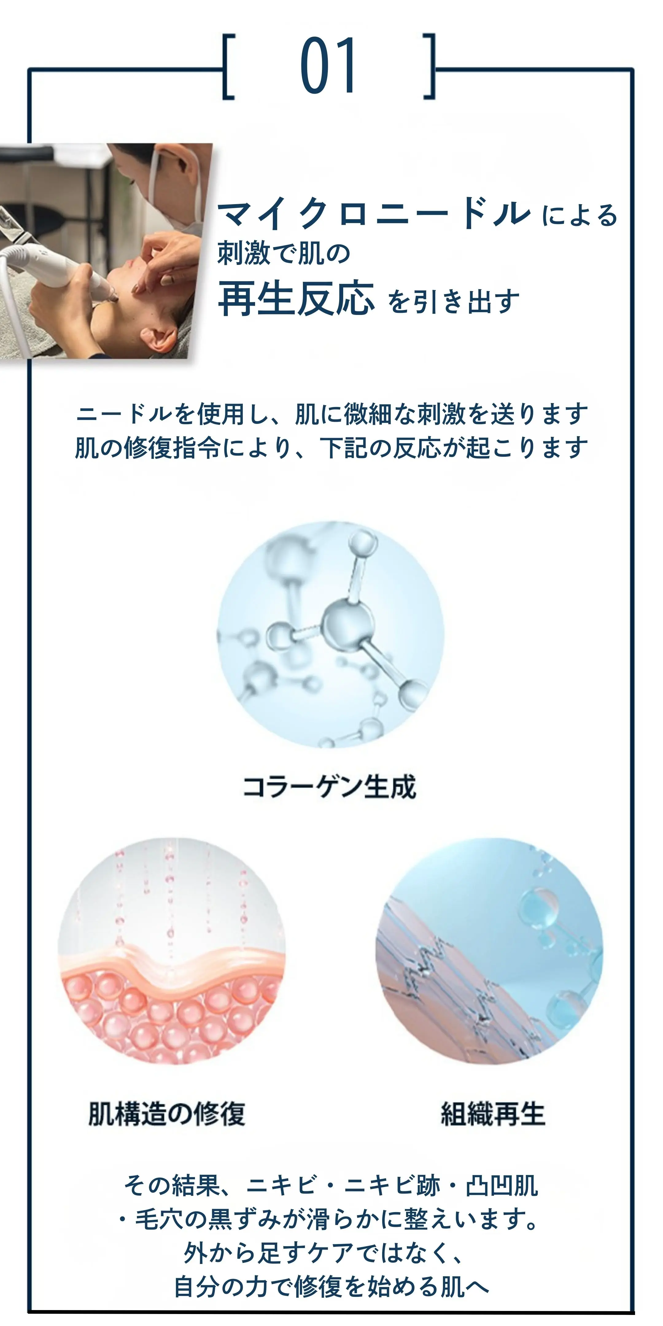 メンズニキビ-つくば市-メカニズム